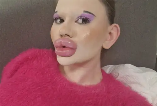 У него самый большой рот в мире. Врачи говорят, что я могу умереть