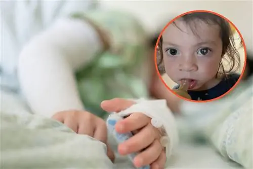 Мать заметила белое пятно в глазу ребенка. Это был симптом злокачественной опухоли