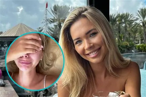 Сандра Кубицка показала свои панические атаки. «Я не сверхчеловек»