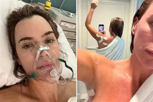 Она игнорировала симптомы рака. Врач диагностировал у нее 12 меланом.