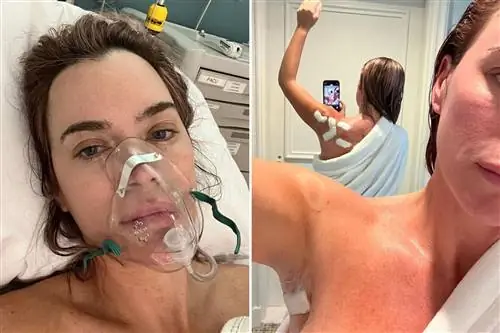 Она игнорировала симптомы рака. Врач диагностировал у нее 12 меланом