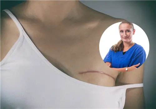 К ней обращаются пациенты с рубцом, сросшимся с кишечником или ребрами. «Можно попасть даже на операционный стол через шрам»