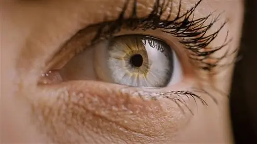 Глаз чесался, с ресниц падали ворсинки. Это оказались гниды и вши