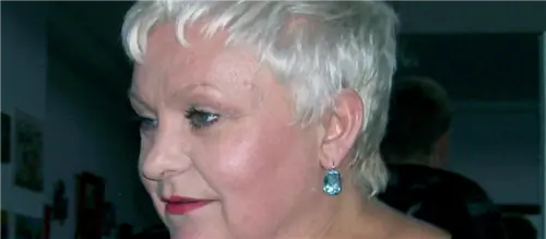 Джоанна Бартель ушла из шоу-бизнеса из-за болезни? «Я болен и ничего не делаю»