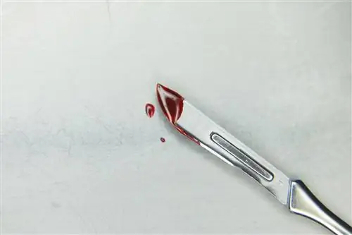 Время кровотечения (ВТ): нормальное