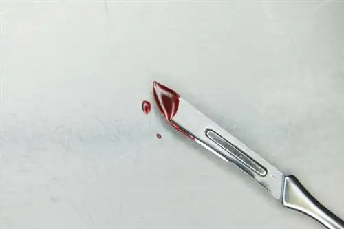 Время кровотечения (BT): нормальное