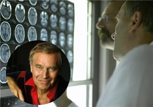 Это был первый признак болезни Альцгеймера. «Если я расскажу смешную историю во второй раз, пожалуйста, смейтесь»