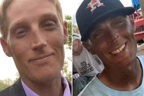 Кожа 33-летнего мужчины изменила цвет после приема препарата. Врачи не могут разгадать эту медицинскую тайну