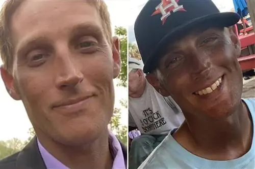 Кожа 33-летней женщины изменила цвет после приема лекарства. Врачи не могут разгадать эту «медицинскую тайну»