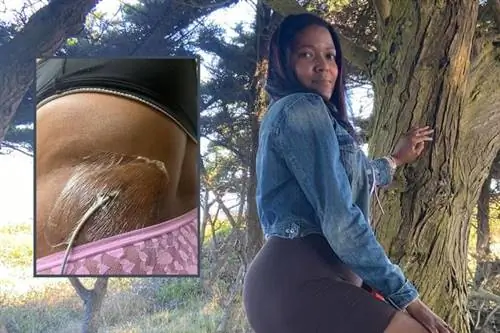 У нее были кисты размером с грейпфрут на яичниках. Боль оставила меня без работы