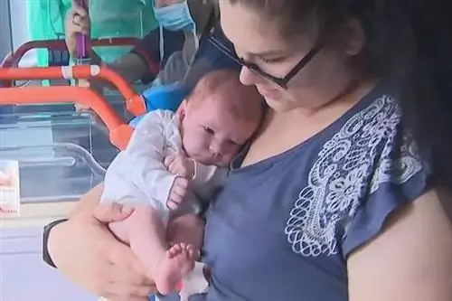 При рождении она весила 6 кг, половину из которых составляла гигантская опухоль. Врачи из Лодзи не сдавались