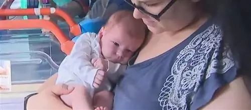 При рождении она весила 6 кг, половину из которых составляла гигантская опухоль. Врачи из Лодзи не сдавались