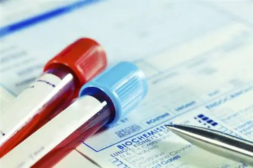 Антитела к ТПО - в норме. Как интерпретировать результаты теста?