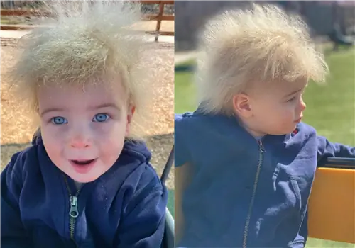 Обнаружено, что стоит за «синдромом нечесаных волос». Эта группа людей наиболее подвержена риску