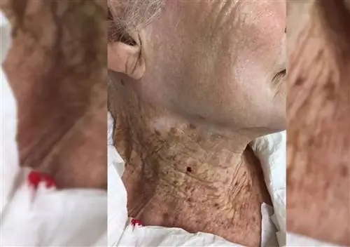 Это фото показывает, насколько эффективны солнцезащитные кремы. Это действительно впечатляет