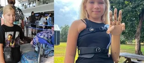 Во время бомбежки сильно покалечилась 9-летняя девочка. Теперь она получила чрезвычайную поддержку