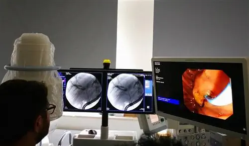 Эндолюминальная РЧА – новый метод паллиативного лечения холангиокарциномы