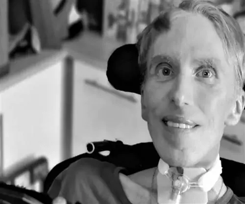 Доктор Питер Скотт Морган мертв. Известен как «первый киборг в истории»