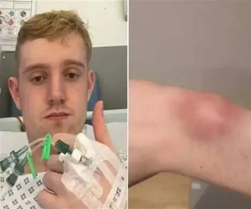 У него болели ноги, оказалось, что он болен редким заболеванием. «Я чувствую, что горю заживо»