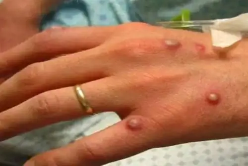 Как ее узнать? [ФОТО]