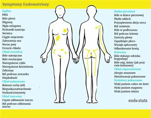 Эндометриоз - симптомы