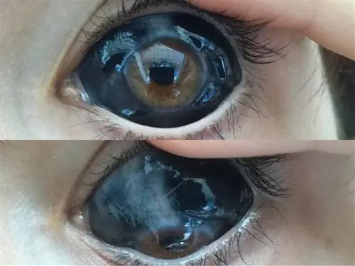 Татуаж глаз: как это делается и безопасно ли это? Узнайте историю девушки, которая чуть не потеряла зрение