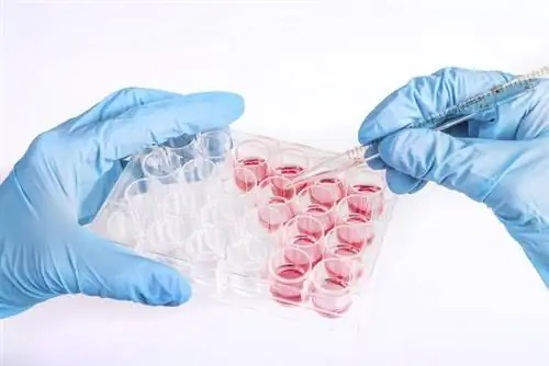 АлАТ (ALAT, ALT, ALT, GPT, SGPT) или аланинаминотрансфераза - стандарты