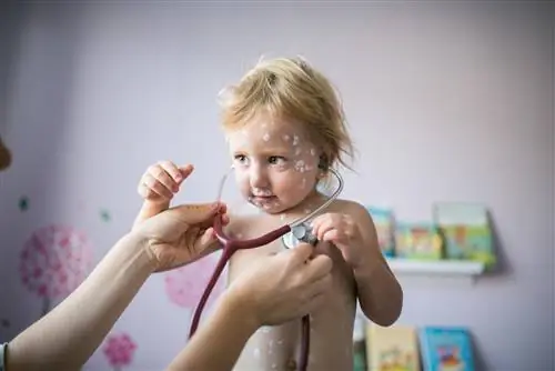 Ветрянка - причины, симптомы, течение, лечение. Как предотвратить оспу?