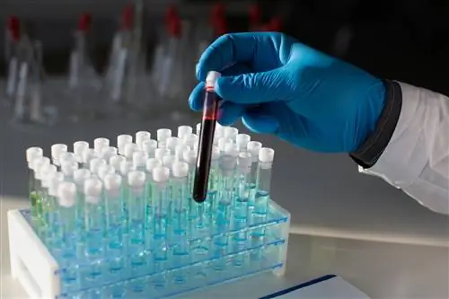 Истинная полицитемия - причины, симптомы и лечение