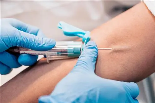 Креатинин - нормы анализа крови. Низкий и высокий уровень креатинина. Как прочитать результат?