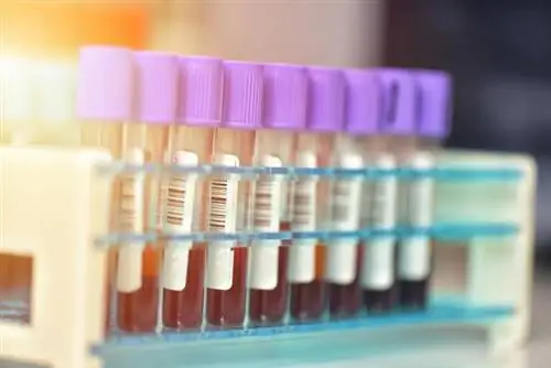 гиперхолестеринемия