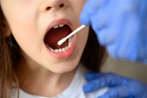 Анализ слюны поможет предсказать тяжесть течения COVID-19 у детей