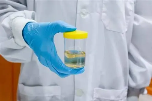 Прозрачная, пенистая, мутная - когда моча должна вызывать опасения?