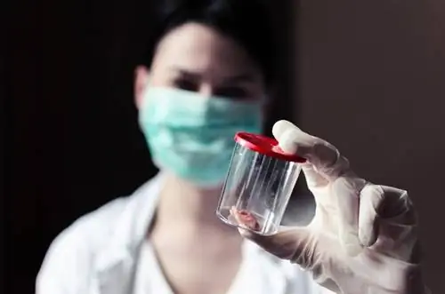 мочевой пузырь