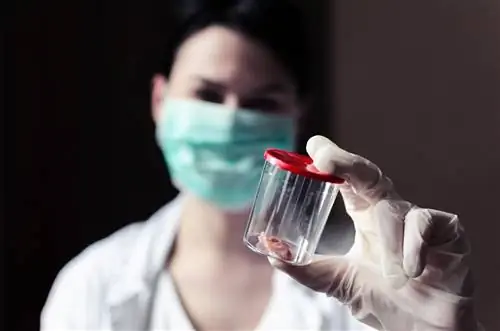 Первые симптомы рака мочевого пузыря. На что следует обратить внимание?