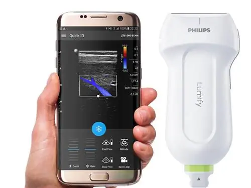 Мобильное УЗИ - как работает современная версия УЗИ?