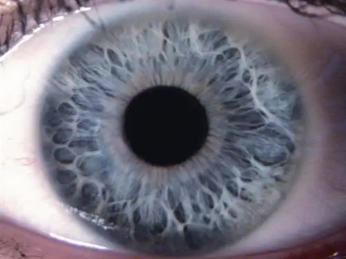 Иридодиагностика - какие болезни можно прочитать по глазам?