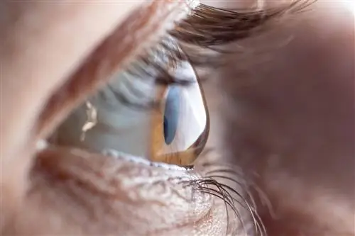 Наиболее распространенные заболевания глаз и дефекты зрения