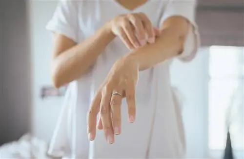 У вас чешется кожа? Это может быть симптомом очень серьезного заболевания