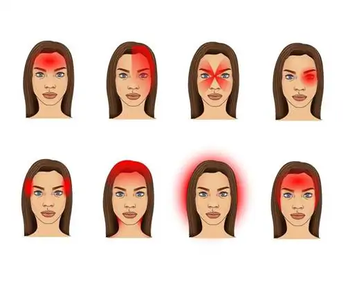 Головные боли