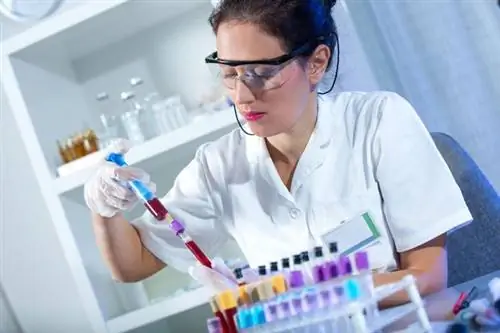 Общий, прямой и непрямой билирубин - в норме