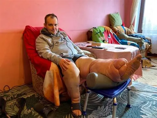 Павел Китлас (39 лет) из Белостока страдает загадочной болезнью. Врачи в Польше не могут ему помочь