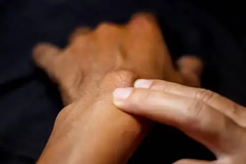 крупный план кисты, т.е. кисты