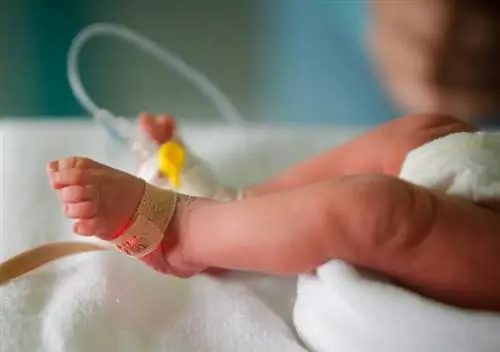 Ноги новорожденного