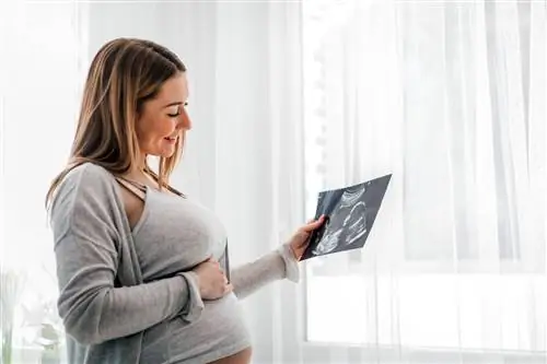 Рак и болезни сердца можно обнаружить уже у плода. Инновационный метод вызывает споры