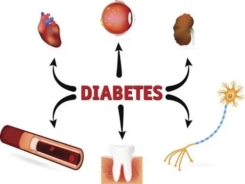 Сахарный диабет - ранние и поздние осложнения