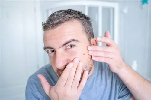 Множественные абсцессы - причины, симптомы и лечение