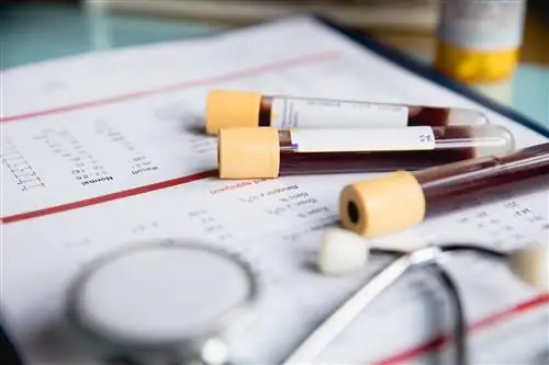 Онкомаркеры (раковые антигены) - вещества, присутствующие в крови онкологических больных