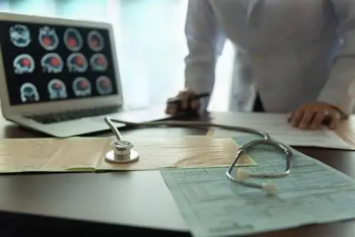 Тест: как распознать инсульт