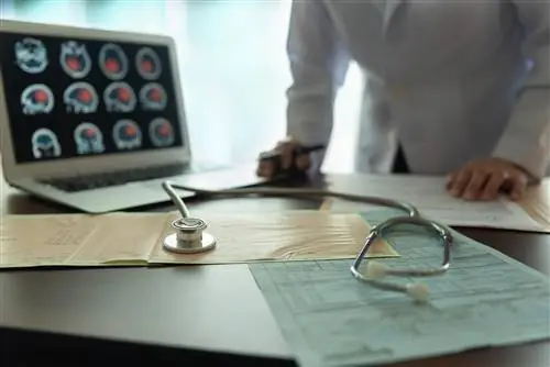 Тест: как распознать инсульт